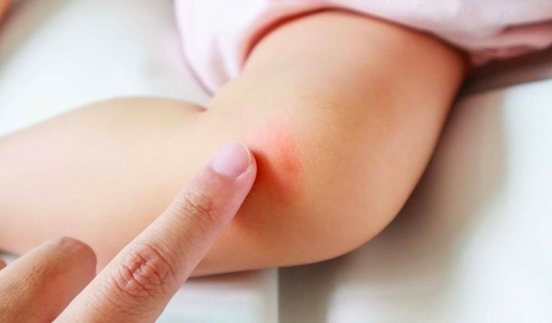 Những tác dụng tuyệt vời của tinh dầu khuynh diệp không thể bỏ qua 2