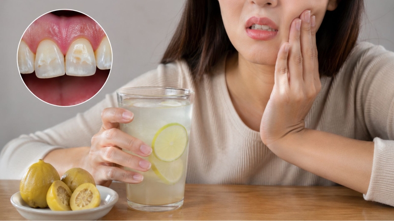 Axit citric trong chanh có thể ảnh hưởng men răng