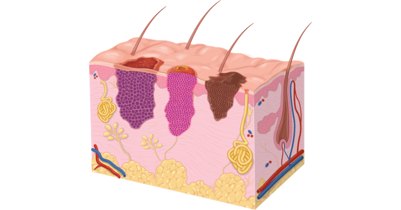 Những tác hại của tia UVA đối với sức khỏe con người 5