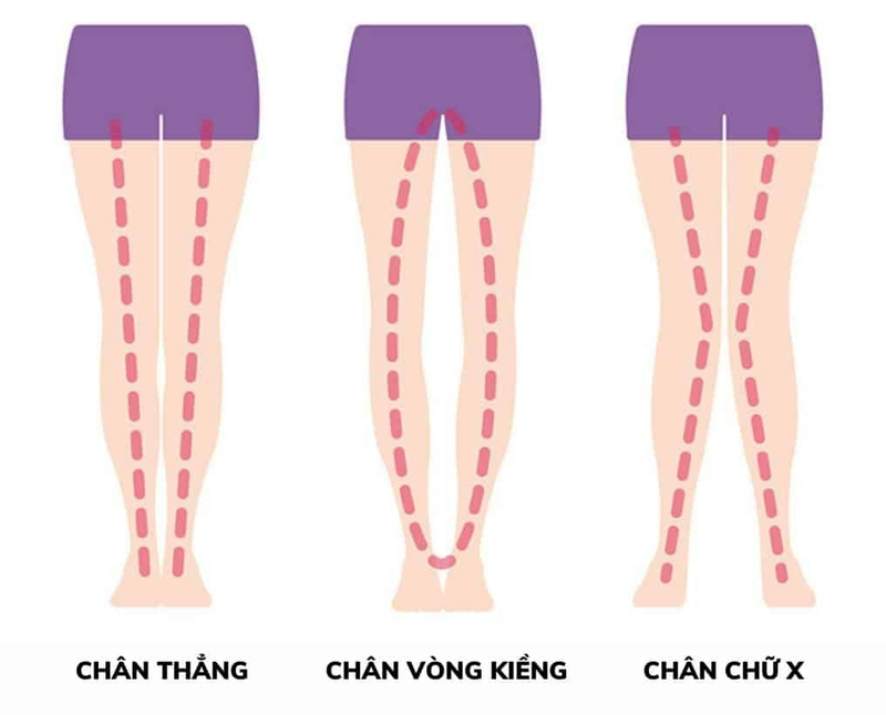 Những thói quen giúp chân thon dài các chị em không nên bỏ qua1