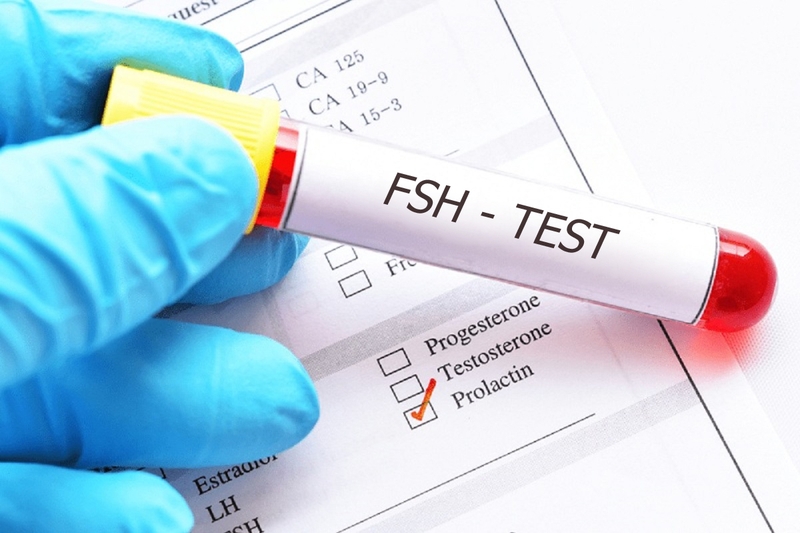 Những thông tin cần biết về xét nghiệm FSH