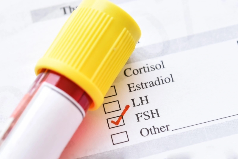Những thông tin cần biết về xét nghiệm FSH 2