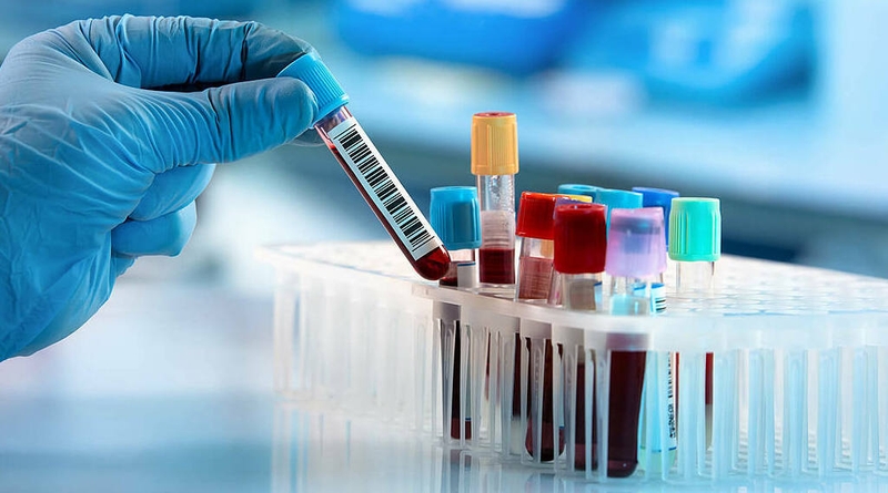 Những thông tin cơ bản về bệnh thận đa nang bẩm sinh không phải ai cũng biết 3