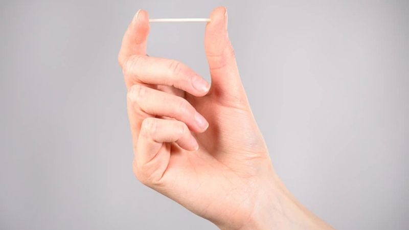 Những thông tin cơ bản về que cấy tránh thai​ không phải ai cũng biết 2