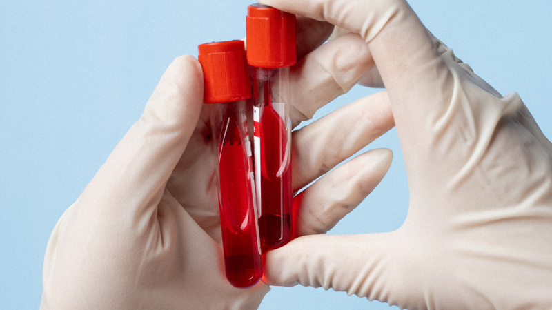 Những thông tin cơ bản về sơ đồ đông máu và các yếu tố đông máu 4