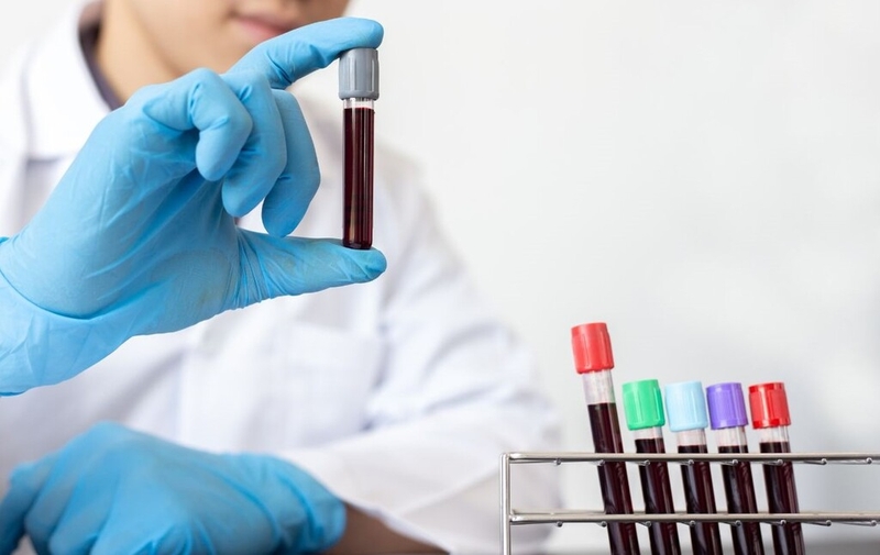 Những thông tin cơ bản về sơ đồ đông máu và các yếu tố đông máu 3