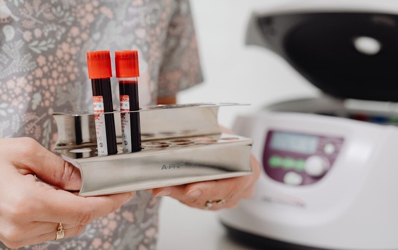 Những thông tin cơ bản về sơ đồ đông máu và các yếu tố đông máu 4