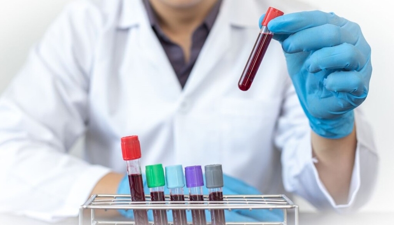 Những thông tin cơ bản về xét nghiệm lipid máu bà bầu không phải ai cũng biết 1