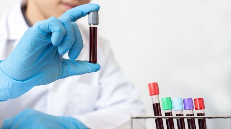 Những thông tin cơ bản về xét nghiệm lipid máu bà bầu không phải ai cũng biết 3