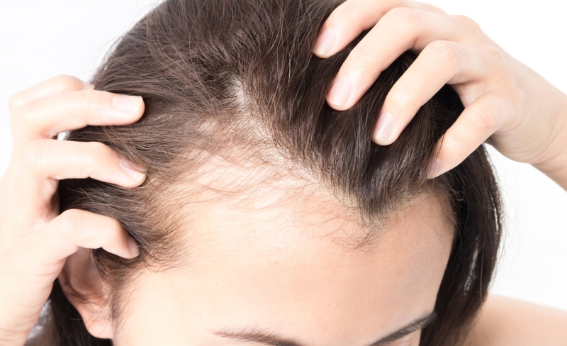 Những tinh chất chống gãy rụng giúp mẹ bầu sau sinh trị rụng tóc hiệu quả 1