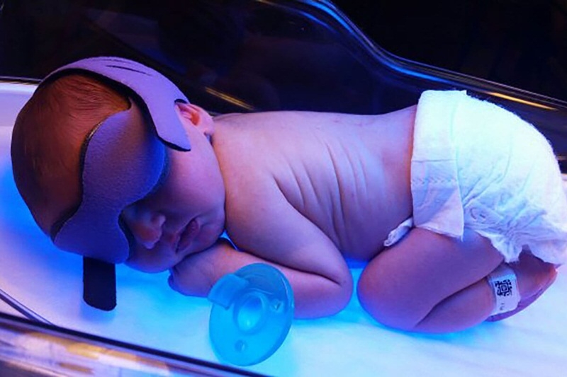 Những triệu chứng của bệnh vàng da ở trẻ và cách chữa trị 3