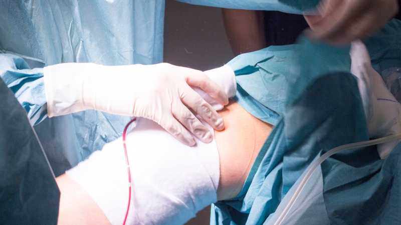 Phẫu thuật dẫn lưu áp xe qua da là gì? 3