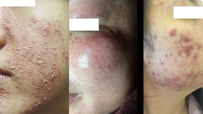 Những vấn đề cần biết về kem trộn trắng da cấp tốc 3