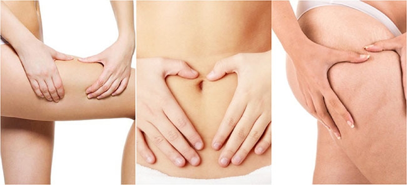 Những vùng da dễ bị rạn nhất bạn cần chú ý