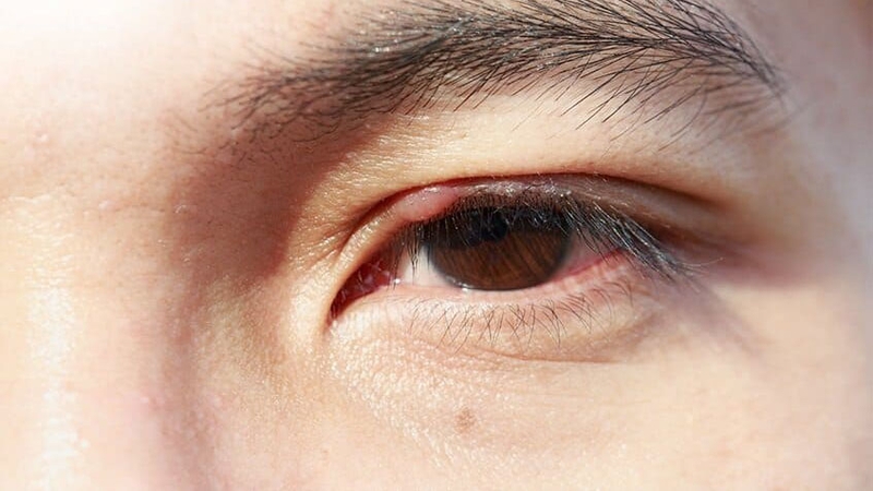 Nhuộm lông mày là gì? Bật mí 5 cách nhuộm lông mày đơn giản, an toàn 5