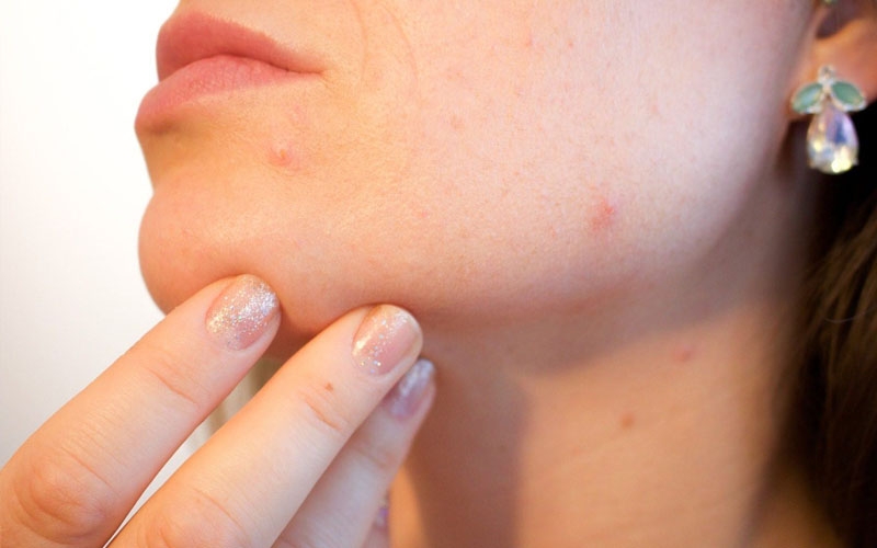 Uống nhụy hoa nghệ tây nóng hay mát, có nổi mụn không?