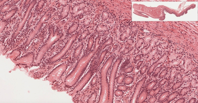 Niêm mạc ruột là gì? Tác động của thực phẩm và lối sống đối với vai trò của niêm mạc ruột 2