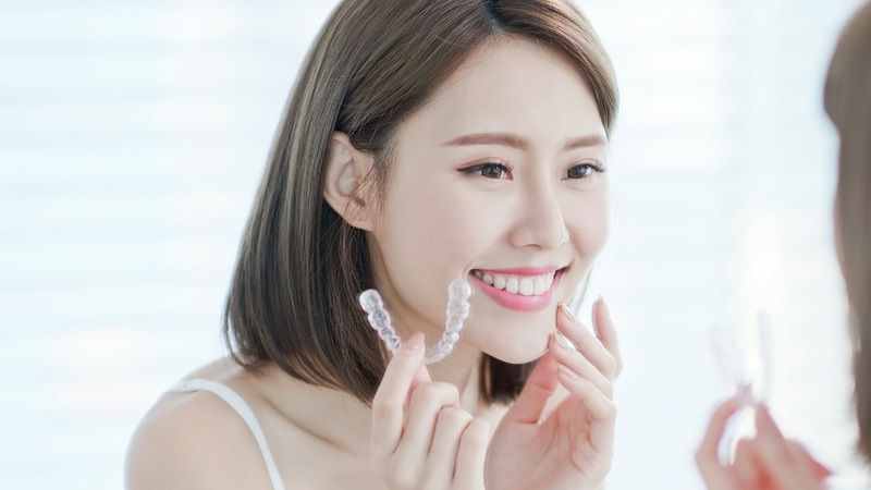 Niềng 4 răng cửa thường mất 1,5 - 2 năm, có thể kéo dài đến 3 năm