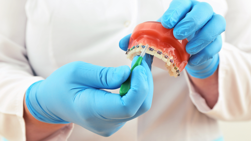 Niềng răng có đi máy bay được không? Một số lưu ý khi đi máy bay trong lúc niềng răng 4