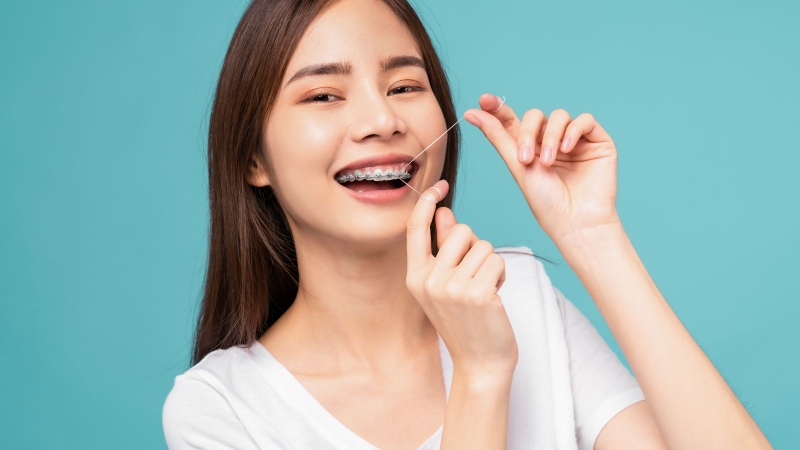 Khi niềng răng, răng được kéo lùi vào trong, môi cũng theo đó mà gọn lại