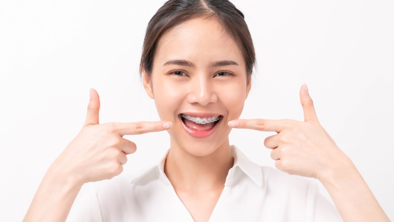 Khi răng và hàm được điều chỉnh đúng vị trí, toàn bộ cấu trúc khuôn mặt trở nên cân đối hơn