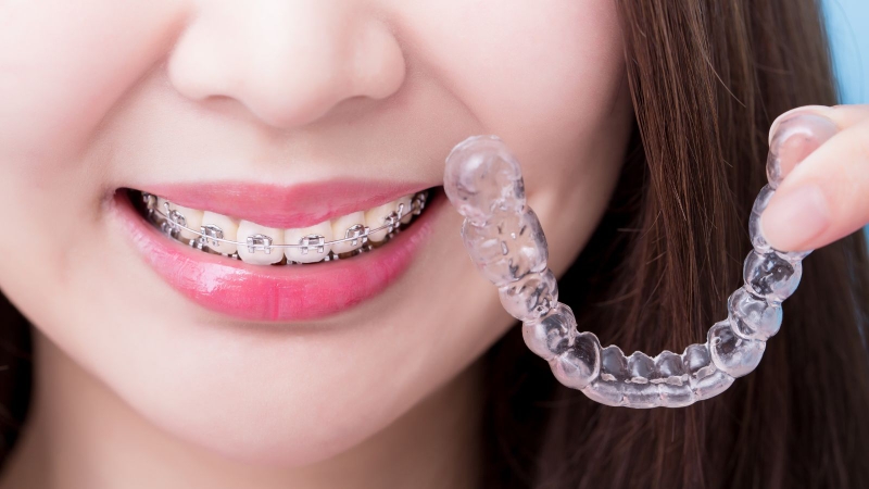 Trong quá trình điều trị, người niềng răng có thể gặp một số khó khăn
