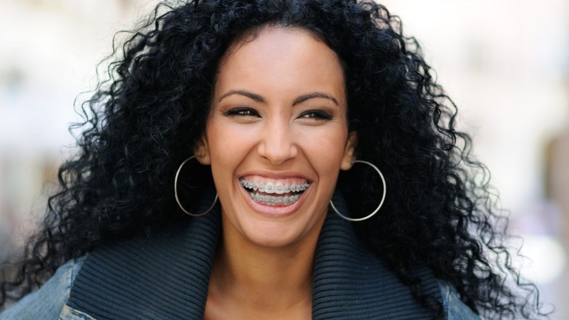 Niềng răng có hết lệch mặt không? Các phương pháp niềng răng hỗ trợ trị lệch mặt? 3