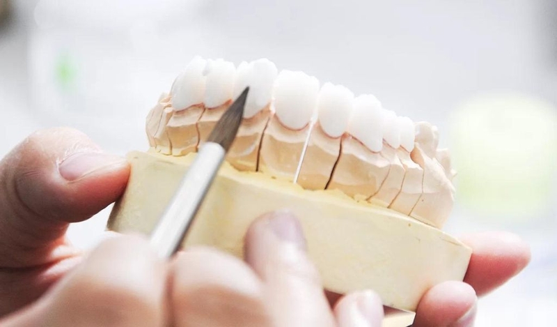 Niềng răng có làm răng dài ra không? Cách làm dài răng phổ biến? 3