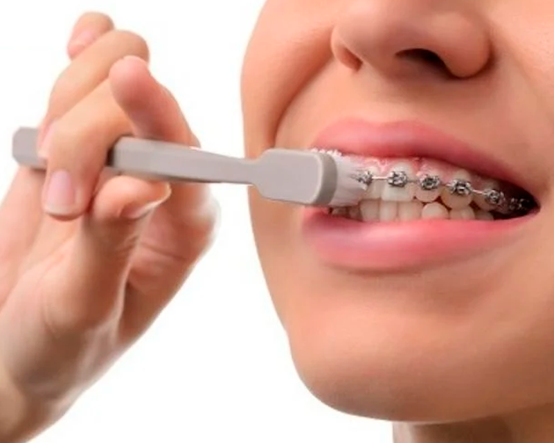 /nieng-rang-co-nen-nhai-keo-cao-su-khong 3