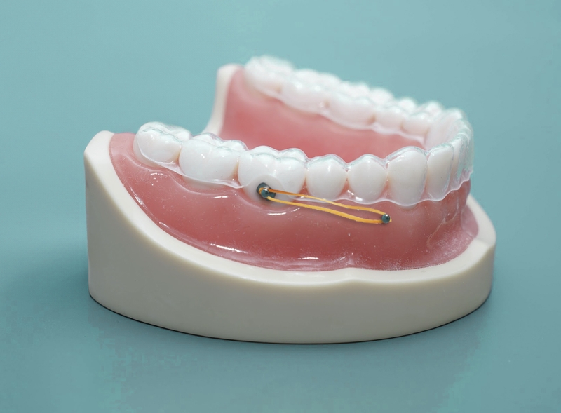 Thủ thuật đặt mini vít cần tiêm thuốc tê vì có xâm lấn mô mềm gây đau đớn cho người bệnh