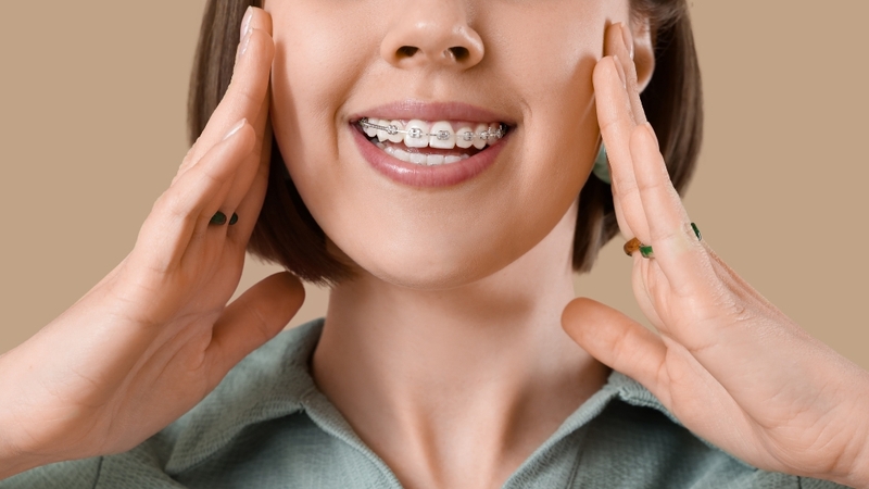 Niềng răng hô giúp cải thiện thẩm mỹ, khớp cắn và sức khỏe răng miệng lâu dài