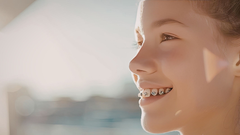 Ở giai đoạn từ 10 - 16 tuổi, xương hàm còn trong thời kỳ tăng trưởng, mật độ xương chưa hoàn toàn ổn định, khả năng tái tạo mô xương cao