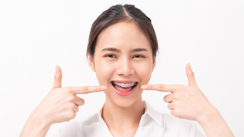 Niềng răng móm có ưu điểm gì? Những điều cần lưu ý trong quá trình niềng răng móm 4