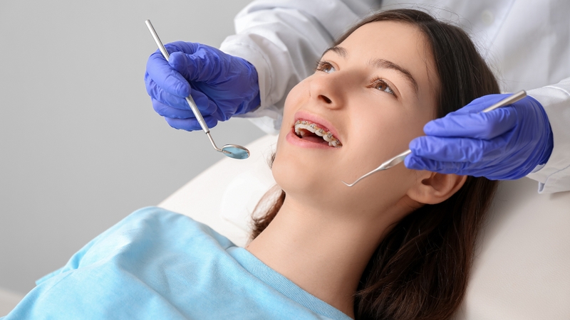 Niềng răng móm có ưu điểm gì? Những điều cần lưu ý trong quá trình niềng răng móm 7