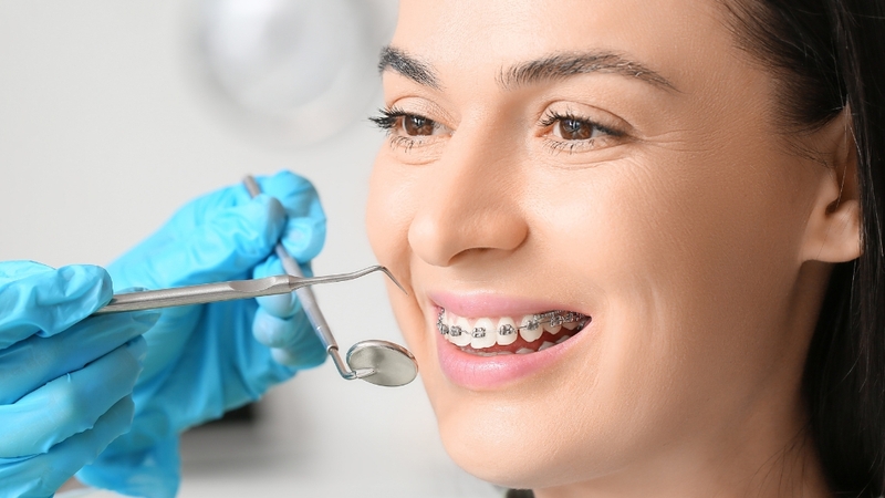 Niềng răng người lớn phức tạp do xương hàm ổn định và nhiều vấn đề răng miệng đi kèm