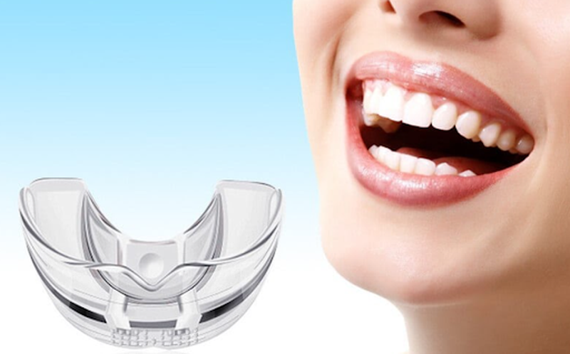 Những điều cần biết về niềng răng silicon