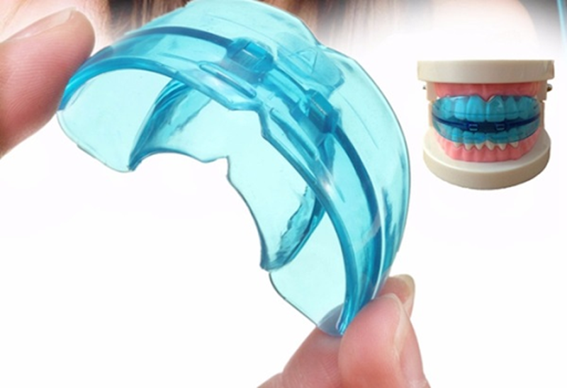 Những điều cần biết về niềng răng silicon