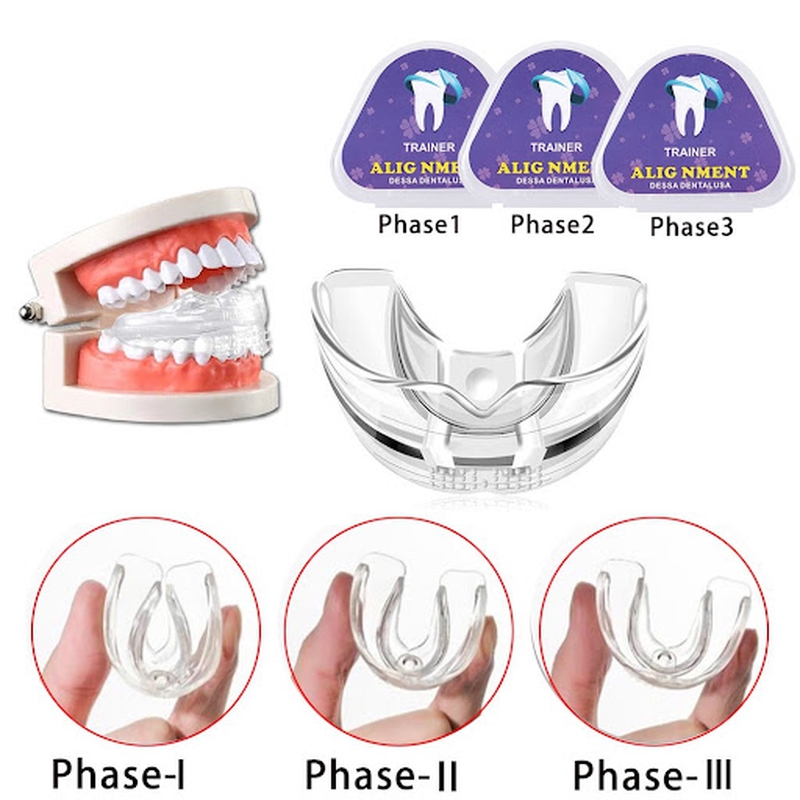 Những Chia Sẻ Về Niềng Răng Trainer A1 A2 A3