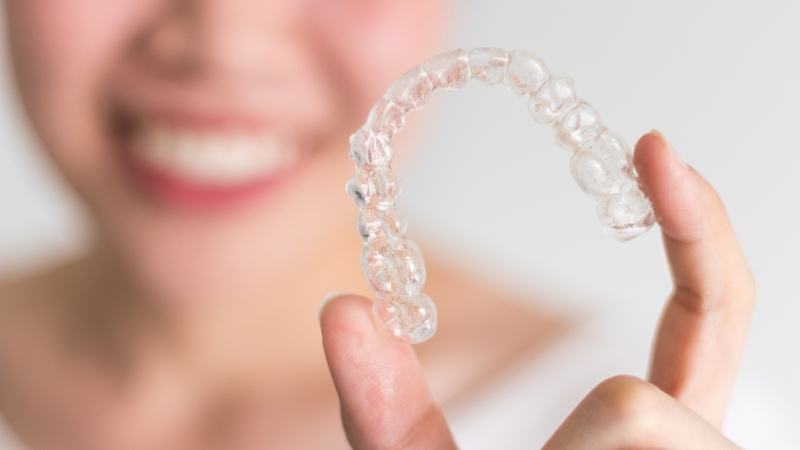 Niềng răng trẻ em có lợi ích gì? Khi nào nên niềng răng cho trẻ 4