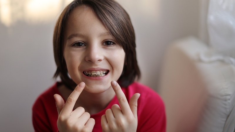 Niềng răng trẻ em có lợi ích gì? Khi nào nên niềng răng cho trẻ 5