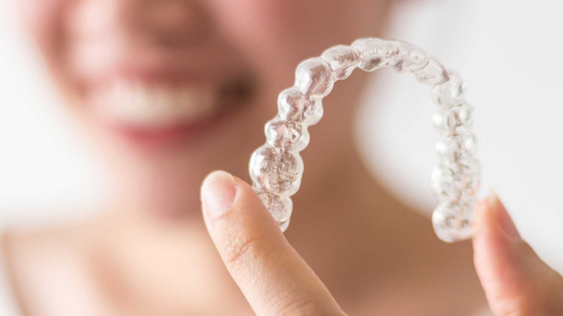 Niềng răng trong suốt giá bao nhiêu? Những điều bạn cần biết 2