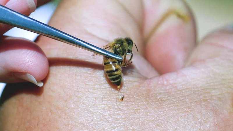 Cần hết sức cẩn trọng với tác dụng phụ của nọc ong