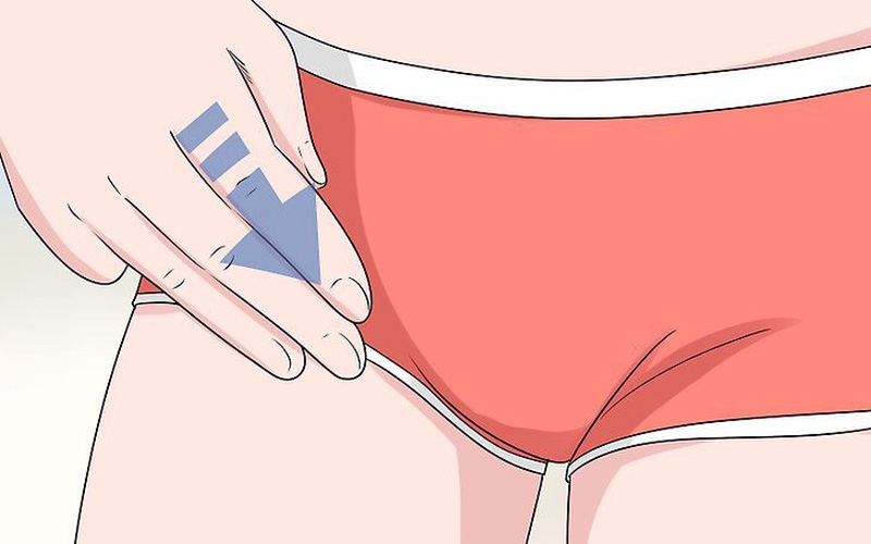 Nổi hạch ở háng có nguy hiểm không? Là dấu hiệu của bệnh gì? 1