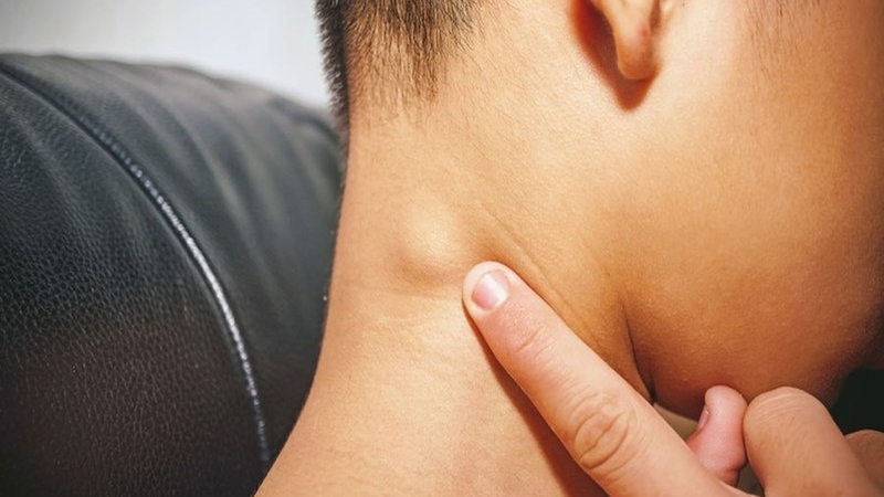 noi-hach-o-mong-la-bi-benh-gi-nen-xu-ly-nhu-the-nao 1