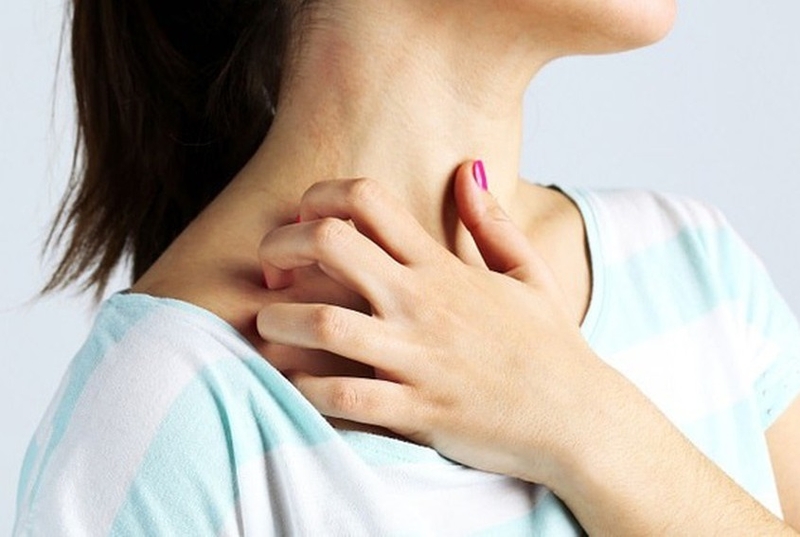 Nổi mề đay sau sinh: Những điều bạn cần biết 1