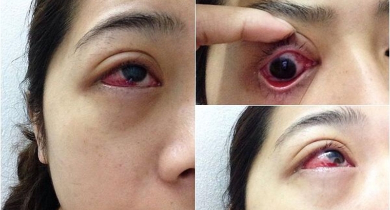 Nối mi có hại không? Những điều cần biết về phương pháp nối mi 3