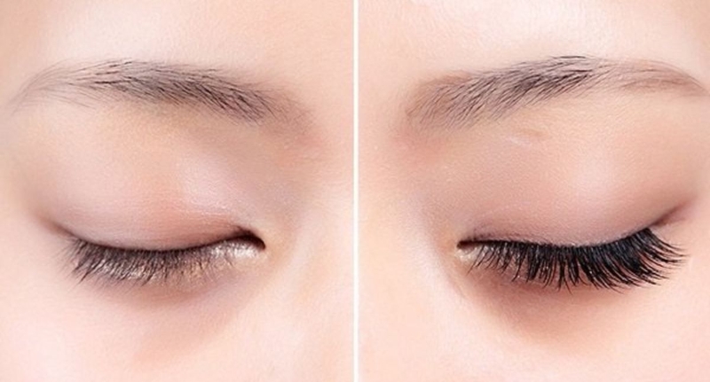 Nối mi có hại không? Những điều cần biết về phương pháp nối mi 5