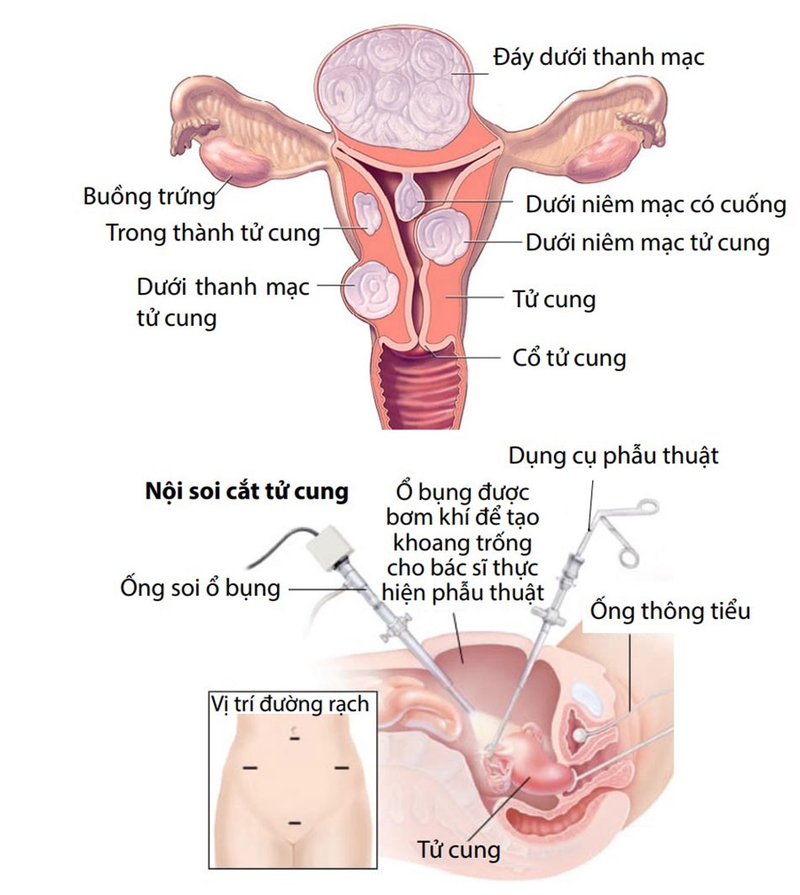 Khi nào nên thực hiện nội soi?
