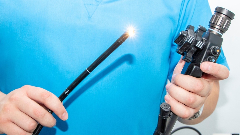 Nội soi đại tràng có phát hiện ung thư không? 2