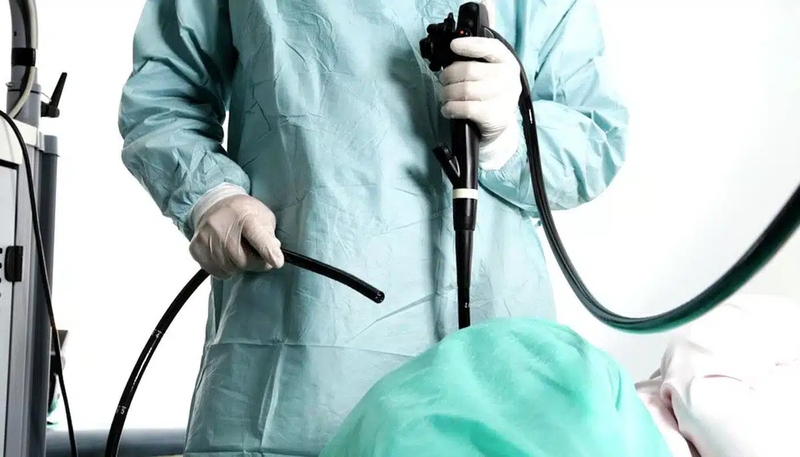 Nội soi đại tràng ống mềm không sinh thiết và những điều cần biết 3